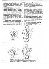 Пособ определения деформации позвоночника (патент 651784)