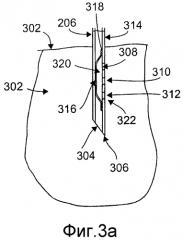 Игольчатая канюля, содержащая лекарственный препарат (патент 2576506)