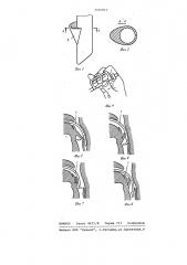 Интубационная трубка (патент 1026813)