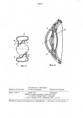 Внутриглазная линза (патент 1386017)