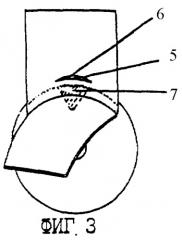 Способ хирургического лечения закрытоугольной глаукомы (патент 2260406)