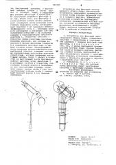 Устройство для фиксации проксимального отдела бедра (патент 862940)