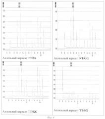 Способ диагностики аллелей t30n, s52g, i199v и r200q гена prkag3 (патент 2328531)