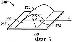 Низкопрофильная система лечения пониженным давлением (патент 2461370)