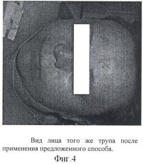 Способ восстановления естественной окраски кожи лица у трупов (патент 2411950)