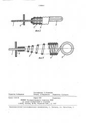 Инструмент для эндодонтии (патент 1388021)