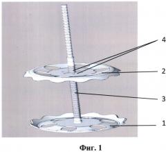 Имплантируемый фиксатор костного лоскута (патент 2668199)