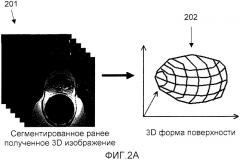 Система и способ для объединения ультразвуковых изображений в реальном времени с ранее полученными медицинскими изображениями (патент 2468436)