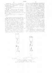 Способ удлинения трубчатых костей (патент 1251890)