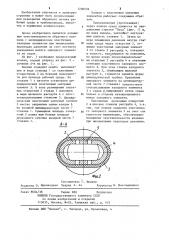 Клапан с эластичным запорным элементом (патент 1206539)