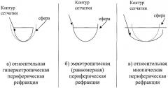 Способ исследования периферической рефракции глаза (патент 2367333)