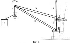 Устройство принудительного передвижения ног (патент 2402311)