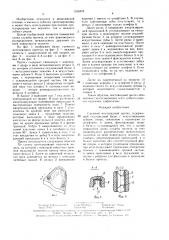 Съемный мостовидный протез (патент 1528476)