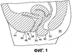 Интерлабиальная прокладка, содержащая язычок (варианты) (патент 2294186)