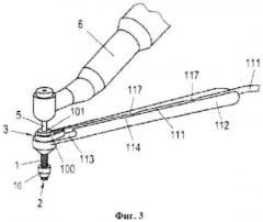 Направляющий элемент и устройство для выполнения отверстия в кости (патент 2558451)