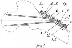 Устройство для остеосинтеза переломов шейки бедренной кости (патент 2448664)