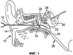 Сольватирующая система и герметик для медицинского применения (патент 2418574)