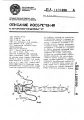 Устройство для тампонады носа (патент 1106490)