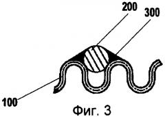 Дискретный анод для катодной защиты железобетона (патент 2416678)