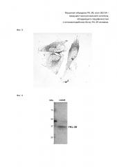 Мышиная гибридома ykl-39, клон 1b2 g4 - продуцент моноклонального антитела, обладающего специфичностью к цитоплазматическому антигену ykl-39 человека (патент 2667423)