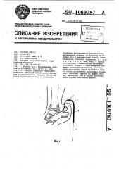Способ закрытой репозиции перелома пяточной кости (патент 1069787)
