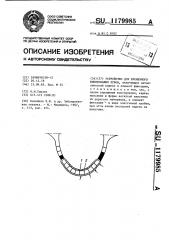 Устройство для временного шинирования зубов (патент 1179985)