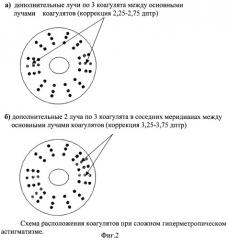 Способ лечения гиперметропии и гиперметропического астигматизма (патент 2313322)
