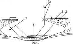 Способ оперативного лечения нагноившегося эпителиального копчикового хода (патент 2277864)