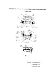 Аппарат для лечения гнатической формы дистальной окклюзии у подростков (патент 2591637)