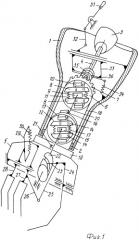 Протез предплечья (патент 2271778)