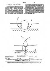 Способ наложения однорядного кишечного шва (патент 1602479)