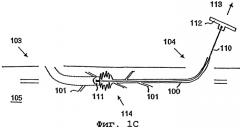 Электрохирургический венозный стриппер (варианты) (патент 2301044)