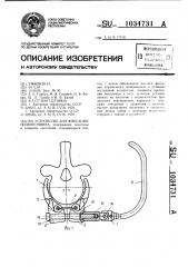 Устройство для фиксации позвоночника (патент 1034731)