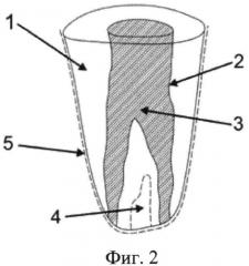 Модель корня зуба (патент 2565132)