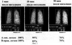 Способ дифференциальной диагностики острых инфекционных заболеваний легких и тромбоэмболий мелких ветвей легочной артерии (патент 2310385)