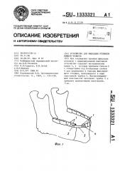 Устройство для фиксации отломков нижней челюсти (патент 1333321)