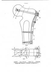 Устройство для остеосинтеза шейки бедренной кости (патент 978838)