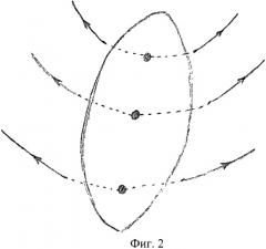 Способ ушивания ложа миоматозного узла после консервативной миомэктомии во время беременности (патент 2482798)
