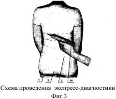 Способ исследования температурного режима поджелудочной железы при диагностике сахарного диабета 1-го типа (патент 2514529)