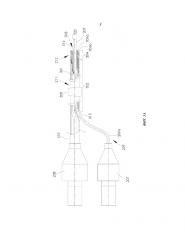 Аппарат и способ для дробления минерально-органических конкрементов (патент 2661014)