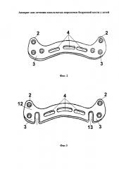 Аппарат для лечения оскольчатых переломов бедренной кости у детей (патент 2629050)
