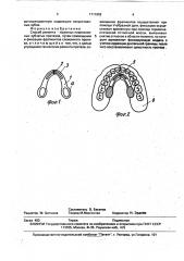 Способ ремонта съемных пластиночных зубных протезов (патент 1711862)