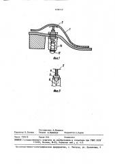 Ортопедическое устройство для плоской стопы (патент 1456142)
