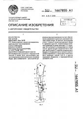 Протез нижней конечности (патент 1667855)