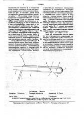 Зонд для промывания толстой кишки при ее непроходимости (патент 1755805)