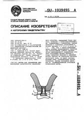 Датчик для определения биофизических характеристик альвеолярного отростка (патент 1039495)