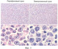 Способ изготовления срезов из свежезамороженной ткани лимфатических узлов (патент 2432575)