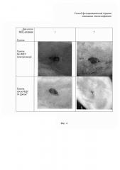 Способ фотодинамической терапии локальных очагов инфекции (патент 2610566)