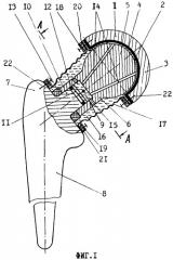 Эндопротез тазобедренного сустава (патент 2245689)