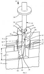 Устройство с инструментом для подготовки или выполнения закрепления имплантата (патент 2449759)